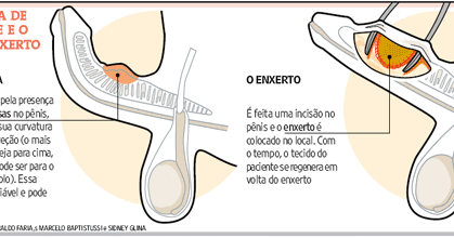 O homem torna-se forte e o membro para ficar pequeno